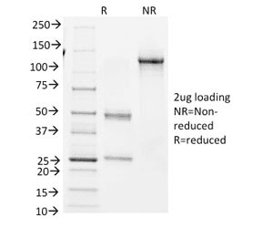 BCL6 Antibody (clone BCL6/1982)