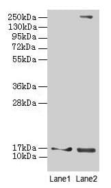IHC-plus™ CRABP1 / CRABP Antibody