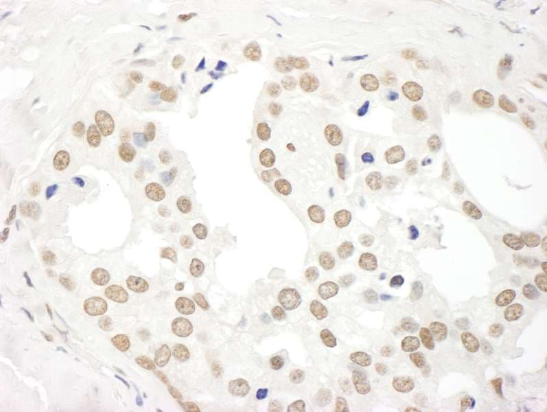 DDX27 Antibody (aa700-750)