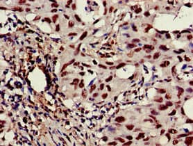 CASP6 / Caspase 6 Antibody