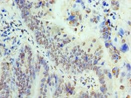 p84 / THOC1 Antibody (aa428-657)