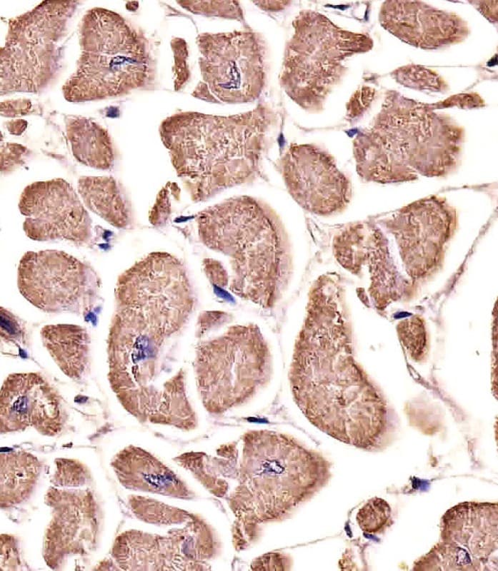Monoclonal Mouse anti-Human MYO18B / Myosin 18B Antibody (clone 1683CT270.39.50, IHC, WB)