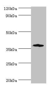 CD200R1 / CD200R Antibody (aa226-325)