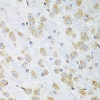 Polyclonal Rabbit anti-Human PDIA3 / ERp57 Antibody (IHC, WB)
