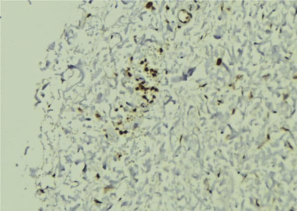 Polyclonal Rabbit anti-Human SGTA / SGT Antibody (IHC, WB)