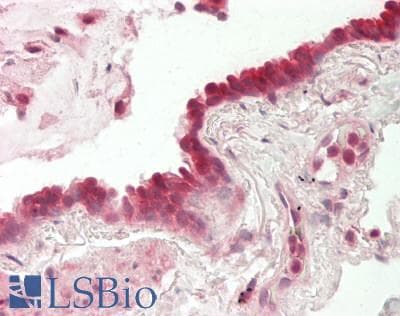 MSANTD3 Antibody (aa101-150)