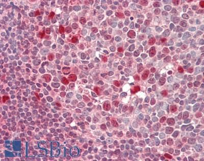 IHC-plus™ Monoclonal Mouse anti-Human TKT / Transketolase Antibody (clone 5H3, IHC, IF, WB)