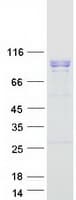 Human WDR36 Protein (Recombinant Myc-DDK (Flag))