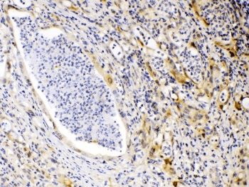 Polyclonal Rabbit anti-Human PRKAR1A Antibody (IHC, WB)