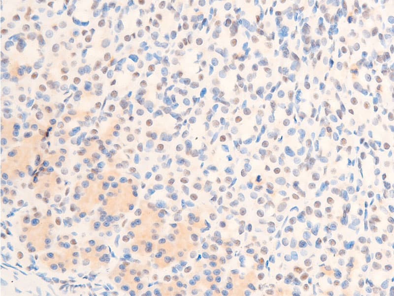 JUN / c-Jun Antibody (phospho-Thr239)