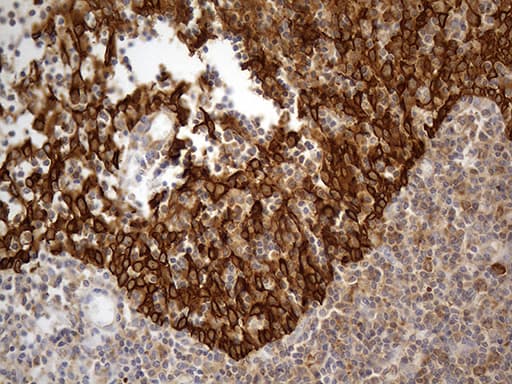ABCF2 Antibody (aa1-235, clone OTI8F4)