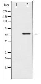 Polyclonal Rabbit anti-Human ABL1 / c-ABL Antibody (IHC, WB)