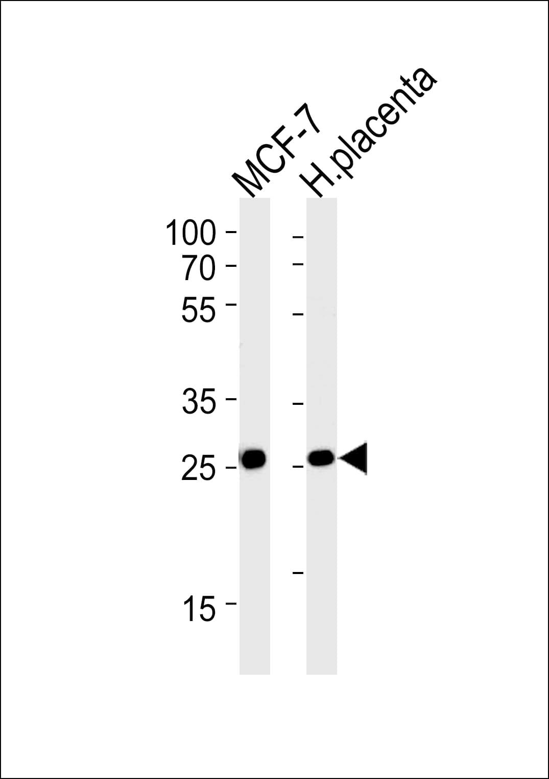 Polyclonal Rabbit anti-Human PRLR / Prolactin Receptor Antibody (aa147-179, WB)
