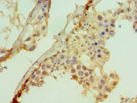 SUFU Antibody (aa325-484)