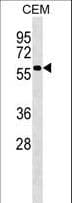 PI4K2A / PI4KII Antibody (aa387-415)