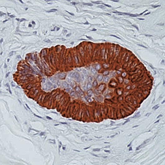 KRT15 / CK15 / Cytokeratin 15 Antibody (C-Terminus, clone LHK15)