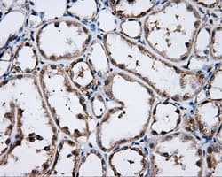 LIPG / Endothelial Lipase Antibody (clone OTI2H10)