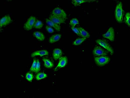 OXTR / Oxytocin Receptor Antibody
