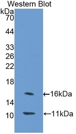 SLC30A8 / ZNT8 Antibody (aa1-80)