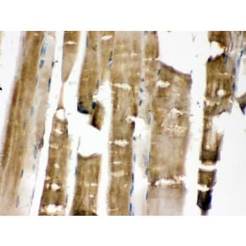Polyclonal Rabbit anti-Human MAP2K3 / MEK3 / MKK3 Antibody (aa311-347, IHC, WB)