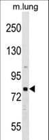 RHPN1 / RHOPHILIN Antibody (aa478-505)