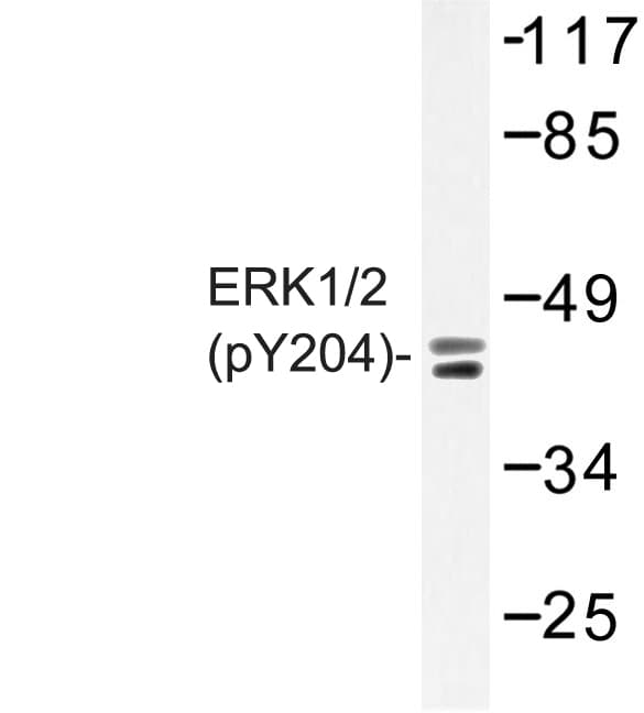 Polyclonal Rabbit anti-Human ERK1 + ERK2 Antibody (phospho-Tyr204, IHC, IF, WB)