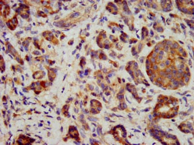 ITGB6 / Integrin Beta 6 Antibody