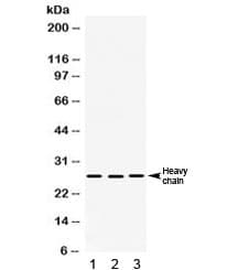 Polyclonal Rabbit anti-Human CTSD / Cathepsin D Antibody (IHC, WB)