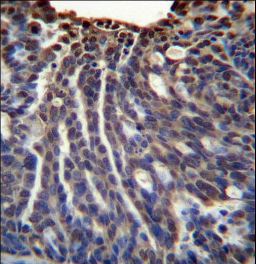 Polyclonal Rabbit anti-Human HOXB3 Antibody (aa119-148, IHC, WB)