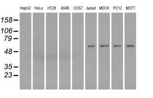 Monoclonal Mouse anti-Human FH / Fumarase / MCL Antibody (clone OTI1F10, IHC, IF, WB)