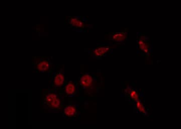 Polyclonal Rabbit anti-Human TINF2 Antibody (IF, WB)