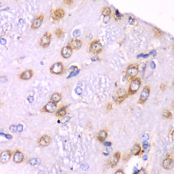 RPS3A / Ribosomal Protein S3A Antibody