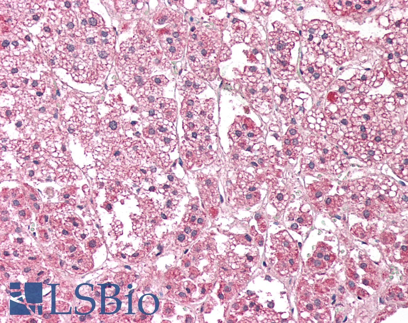 IHC-plus™ HMG-CoA Reductase / HMGCR Antibody