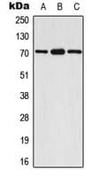 Polyclonal Rabbit anti-Human RPS6KB1 / P70S6K / S6K Antibody (phospho-Ser447, IHC, IF, WB)