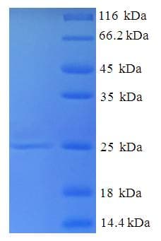 Mouse SELT / Selenoprotein T (Recombinant His)