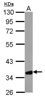 Polyclonal Rabbit anti-Human HMGCL Antibody (aa1-325, IHC, WB)