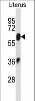 IHC-plus™ SLC2A13 / HMIT / GLUT13 Antibody (aa268-297)
