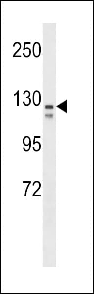 VCAM1 / CD106 Antibody (aa96-124)