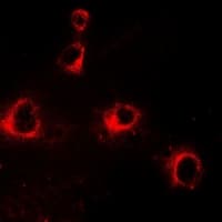 Polyclonal Rabbit anti-Human KIR2DL3 / CD152B2 Antibody (IF, WB)