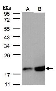 IHC-plus™ Polyclonal Rabbit anti-Human COXIV / COX4 Antibody (aa1-169, IHC, WB)