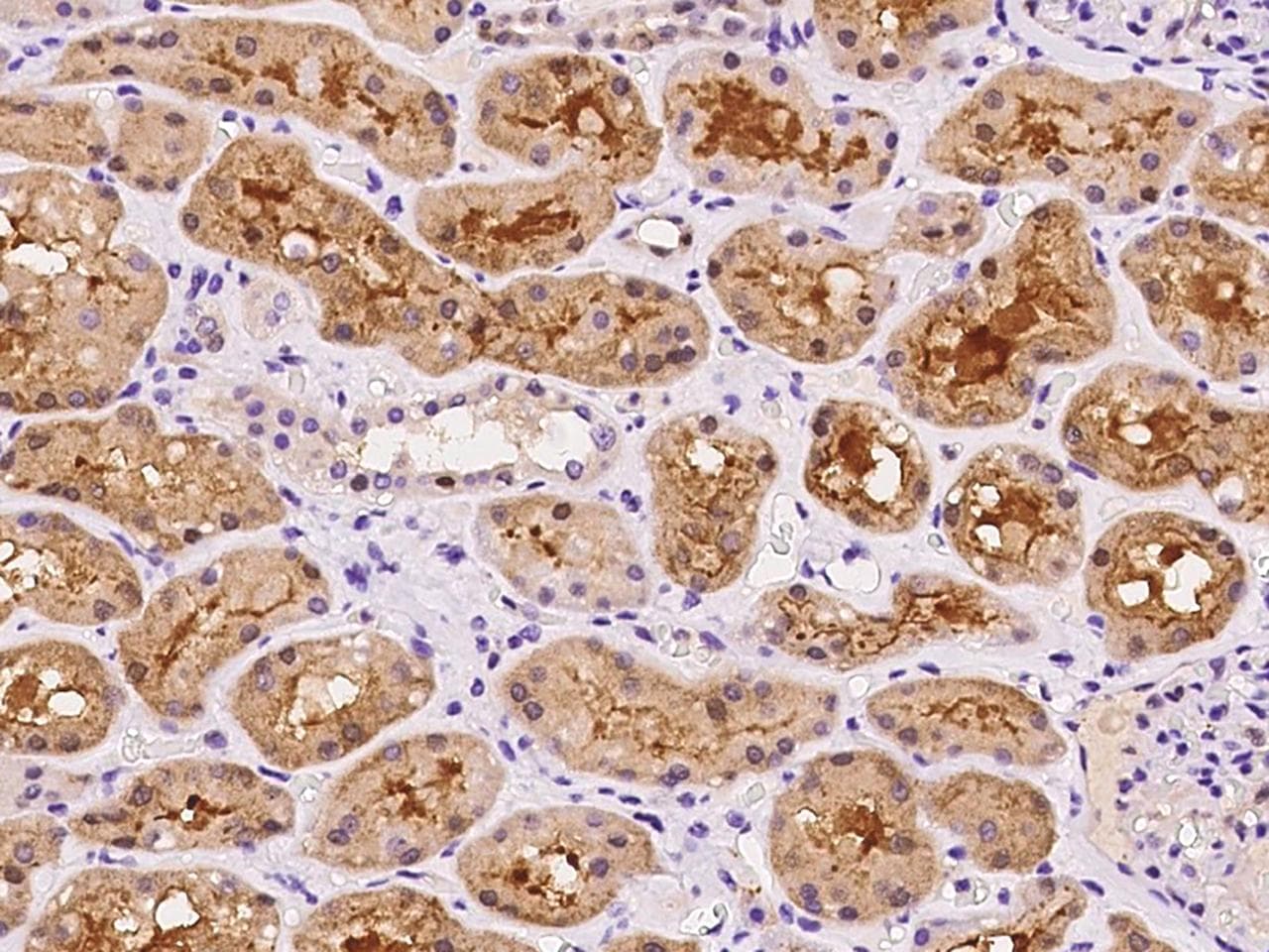 Dipeptidyl Peptidase 3 / DPP3 Antibody