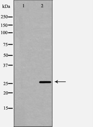 Polyclonal Rabbit anti-Human TREM1 Antibody (WB)