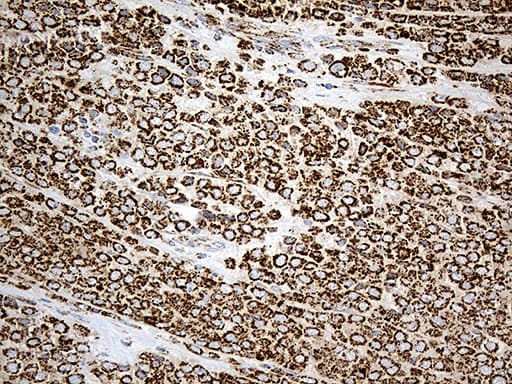 Monoclonal Mouse anti-Human MCAD / ACADM Antibody (clone OTI2G7, Carrier-free, IHC, WB)