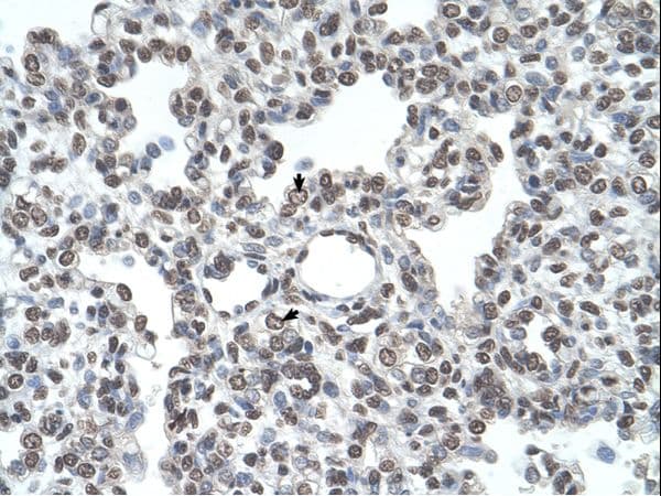 Polyclonal Rabbit anti-Human TMPRSS11D / HAT Antibody (aa288-337, IHC, WB)