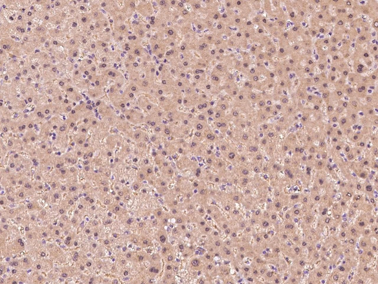 Polyclonal Rabbit anti-Human GSS / Glutathione Synthetase Antibody (IHC)