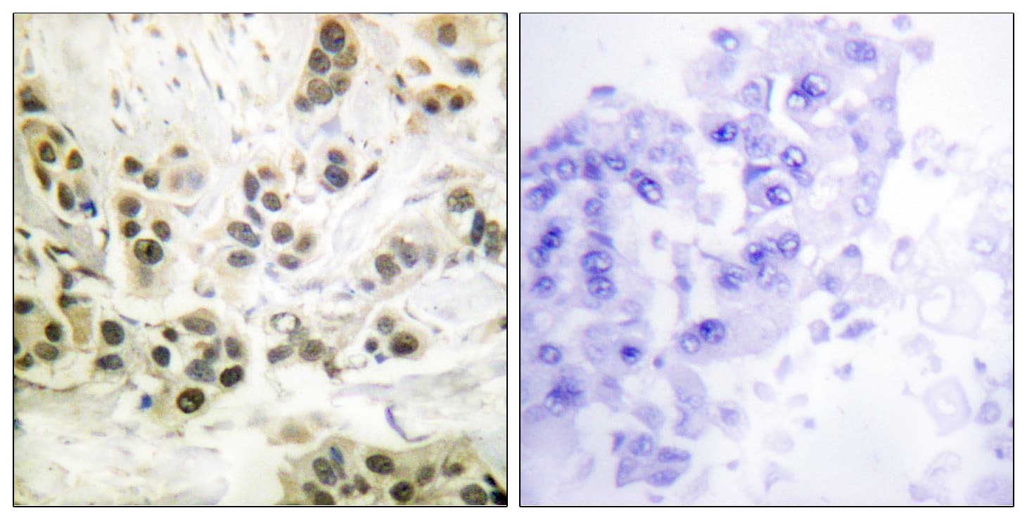 LMNA / Lamin A+C Antibody (phospho-Ser392)