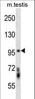 STK10 / LOK Antibody (aa668-696)