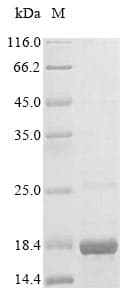 Human SH3PXD2A / TKS5 Protein (Recombinant 10His, N-terminus + Myc, C-terminus)