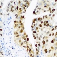PHC1 / EDR1 Antibody