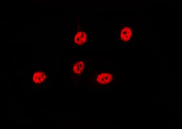 CDKN1A / WAF1 / p21 Antibody